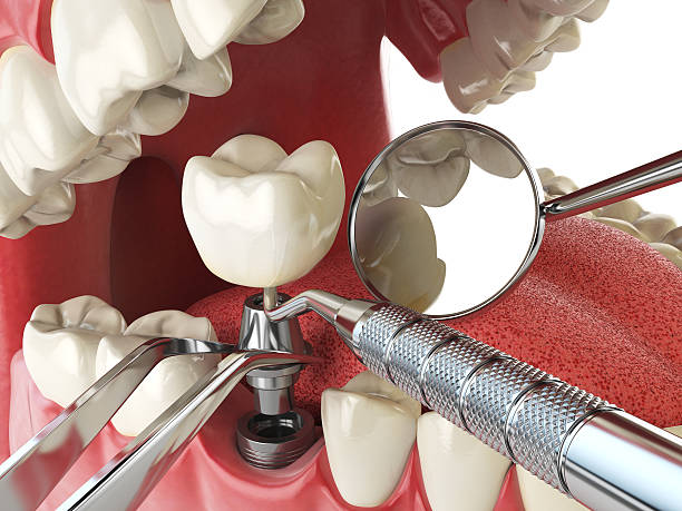 Best Emergency Treatment for Oral Infections in Ashton Sandy Spring, MD